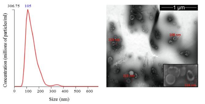 Fig. 1 Trichomonas-derived exosome characterization. (Artuyants, et al., 2020)