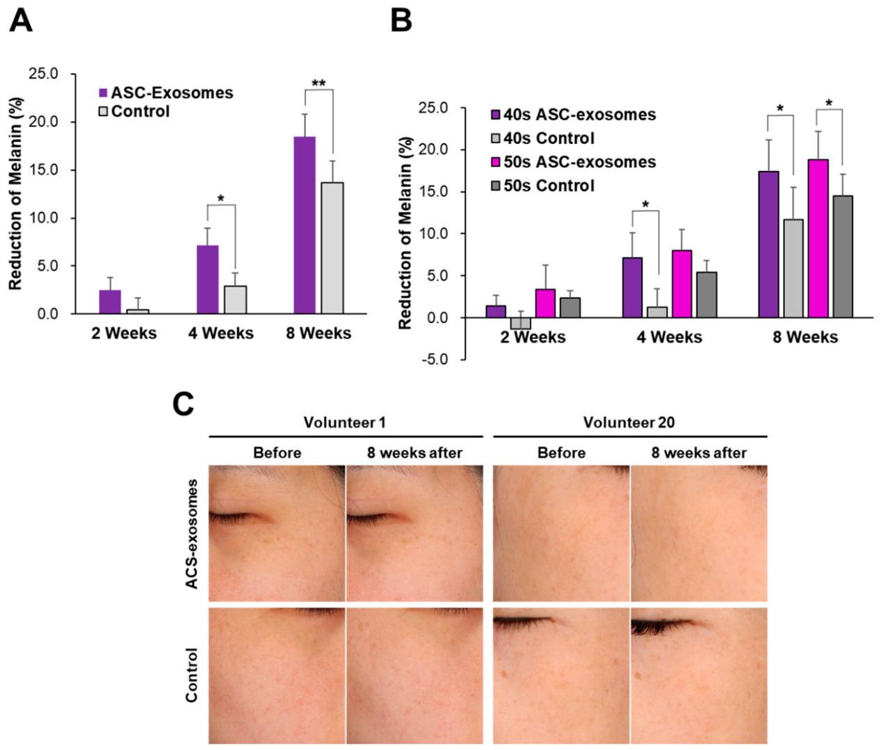 Fig.1 Clinical Study on the Skin Brightening Impact of ASC-Exosomes.