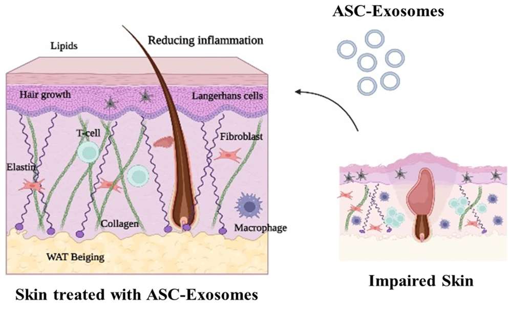 Fig.1 Role of ASC-Derived Exosomes in Treating Skin Disorders.