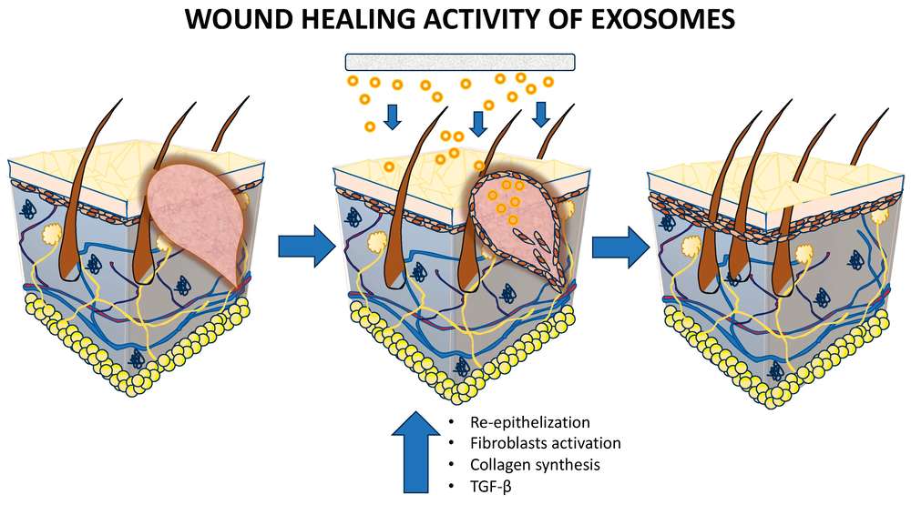 Fig.1 Exosomes for enhanced re-epithelialization and faster wound healing.