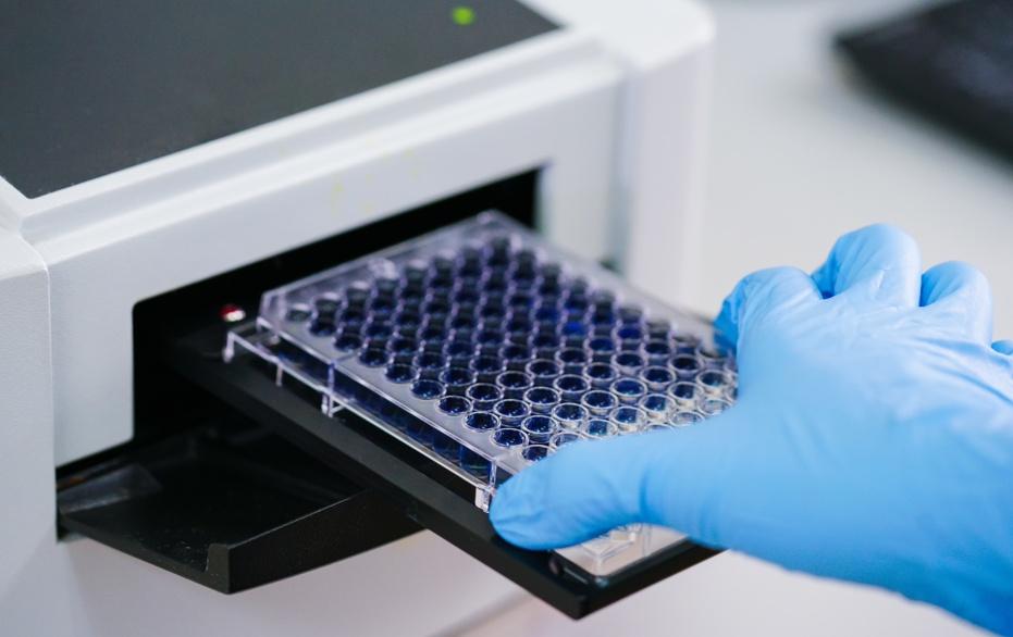 Fig.2 http://47.109.42.40:8006/images/1beb92a5155f9ed43fa29092af7aaff4.jpg. (Creative Biolabs Authorized)