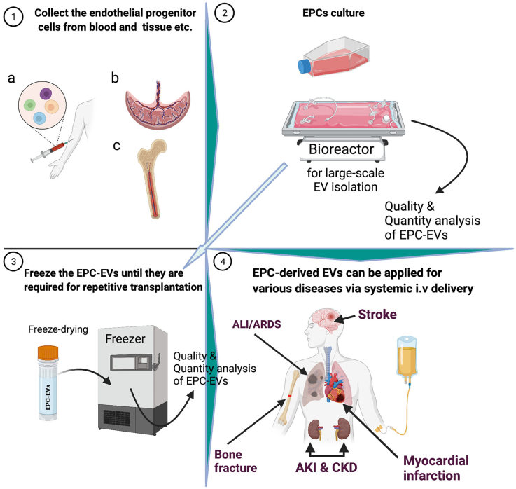 EPC-derived extracellular vesicles. (Salybekov, et al., 2021) (OA Literature)