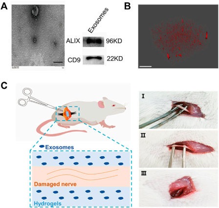 Potential of hydrogel-loaded exosomes. (Liu, et al., 2022) (OA Literature)