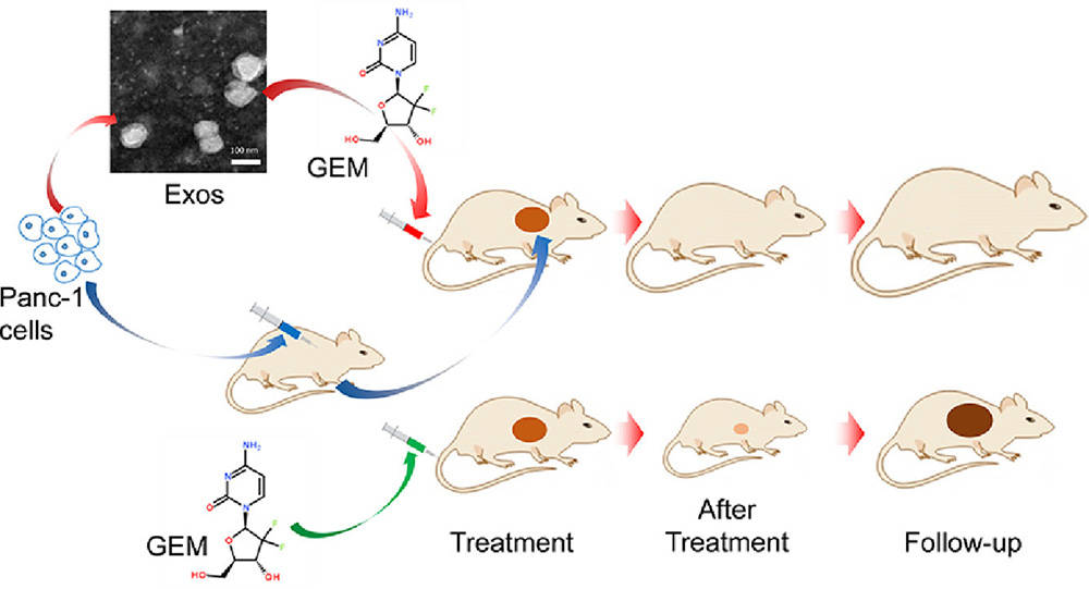 Gemcitabine loaded autologous exosomes for effective and safe chemotherapy of pancreatic cancer.