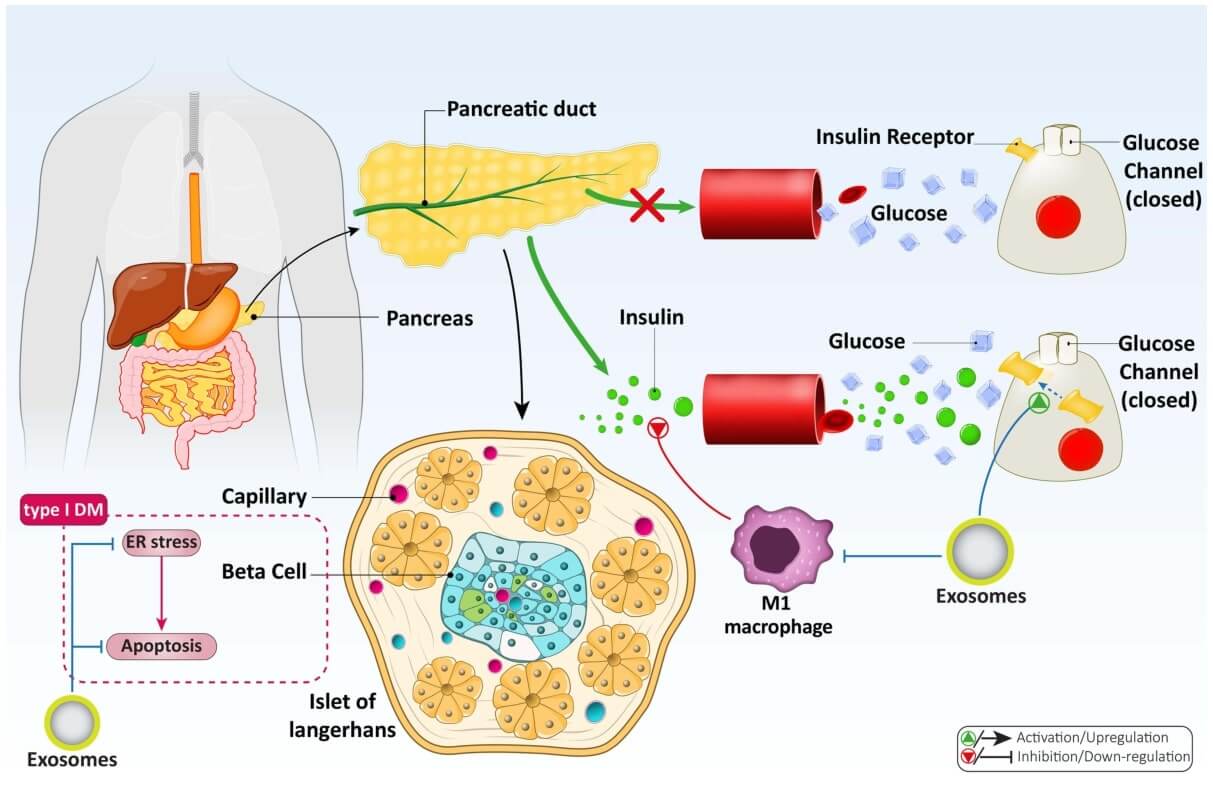 A summary of exosomes and their potential in diabetes treatment.
