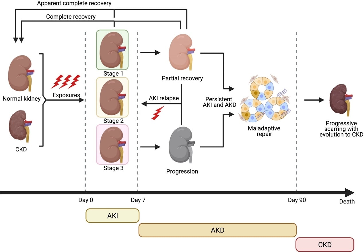 Clinical course of AKI and evolution towards CKD.
