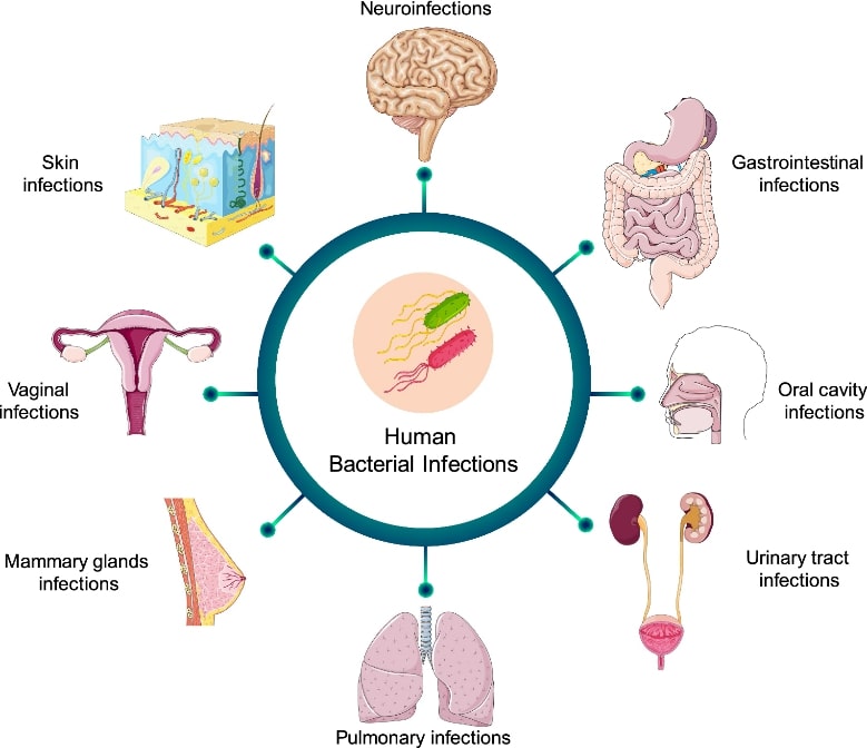 Most common human bacterial infections.