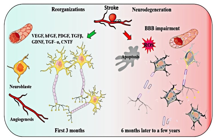 Two events may occur after a stroke, reorganization or neurodegeneration.