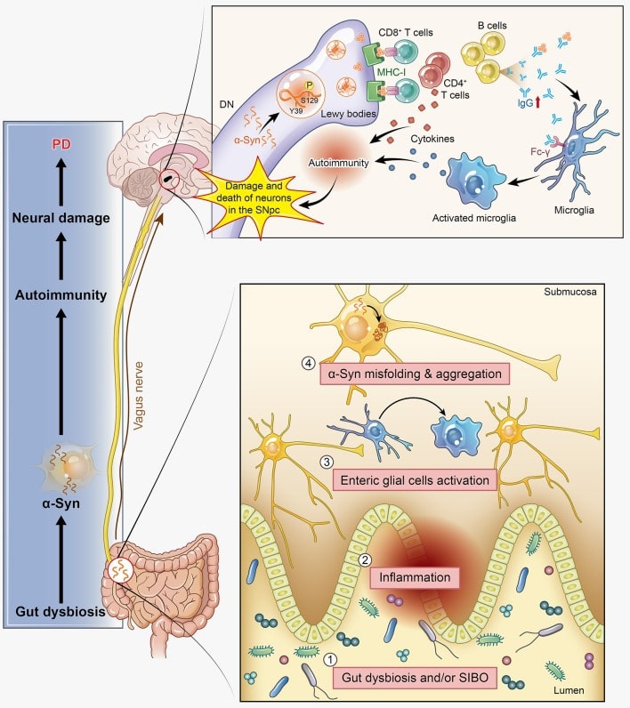 α-Syn participates in autoimmunity and is involved in the pathological progression of PD.