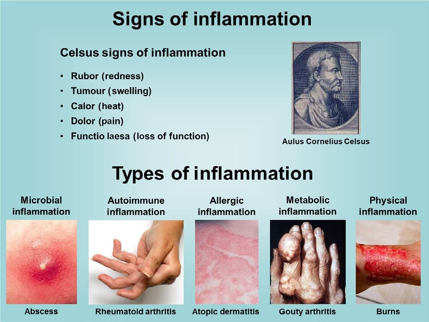 Signs and types of inflammation.