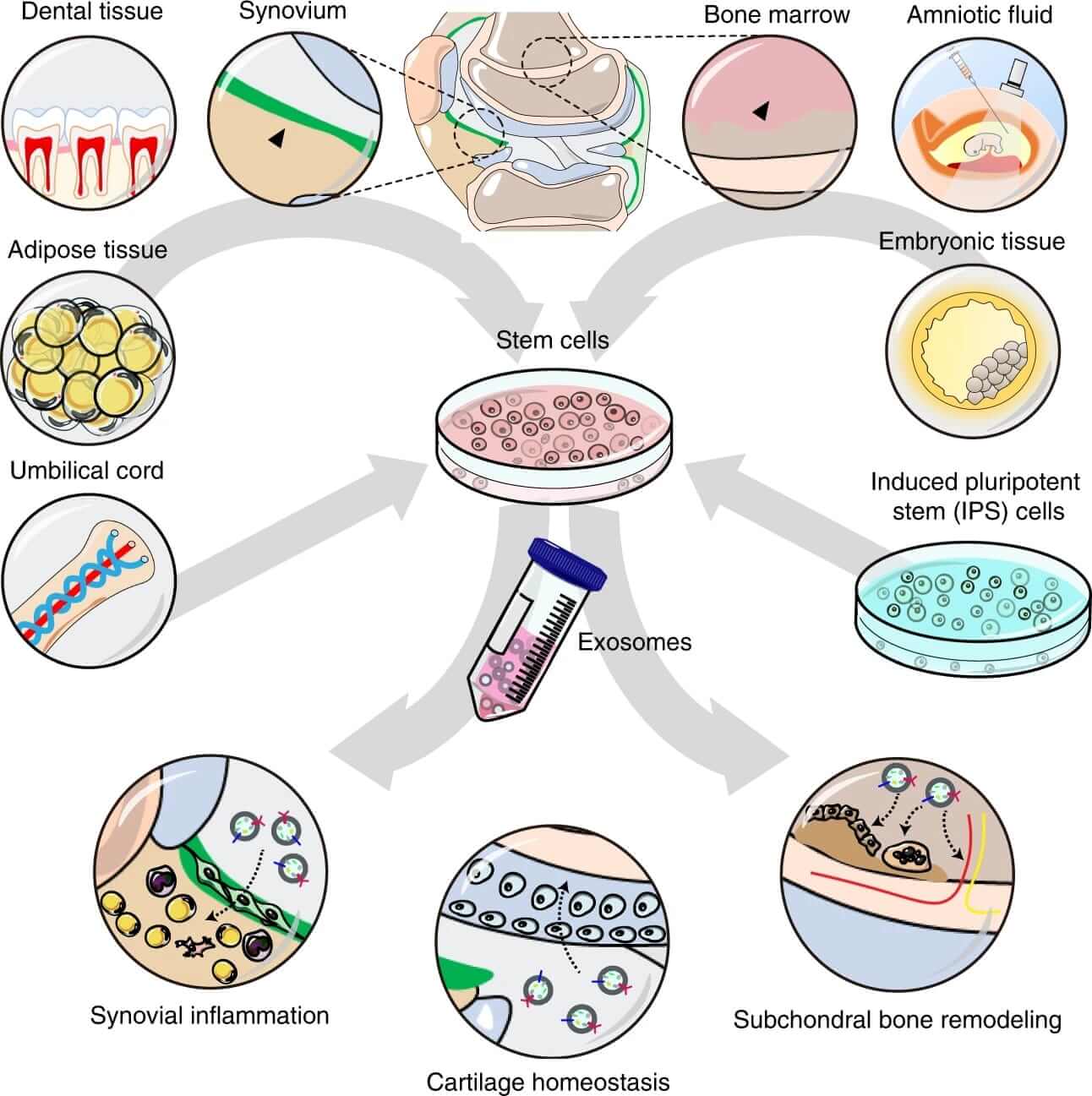 The therapeutic effects of stem cells-derived exosomes on OA.