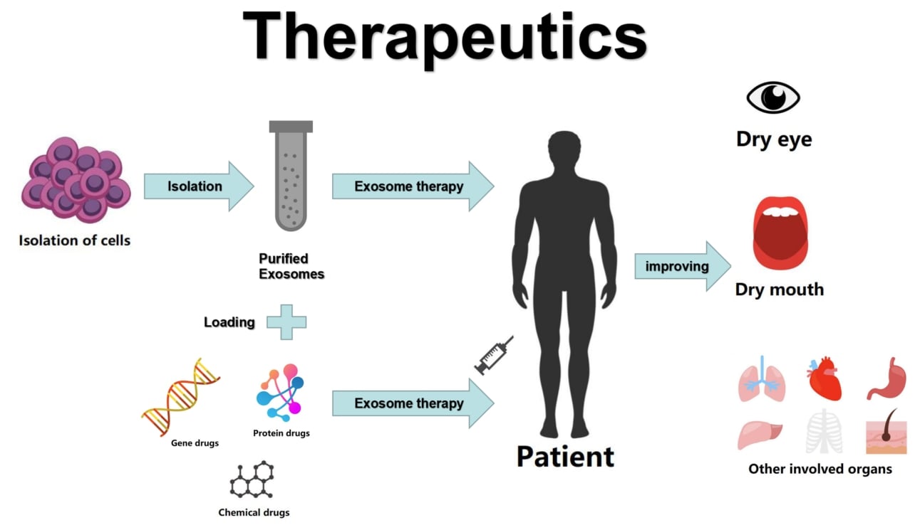 Exosomes as therapeutic tools in eye dryness.