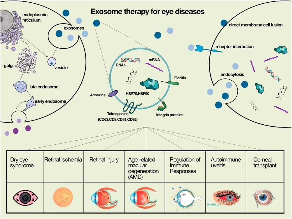 Exosomes have been introduced as a novel agent in cell-free therapy for eye diseases.