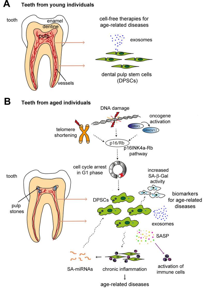 Fig.2 Aging of dental pulp tissue. (Iezzi, et al., 2019) (OA Literature)