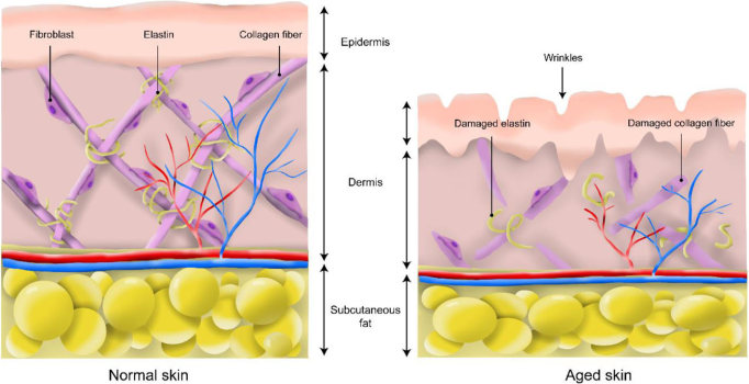 Fig.1 Skin aging. (Yang, et al., 2021) (OA Literature)