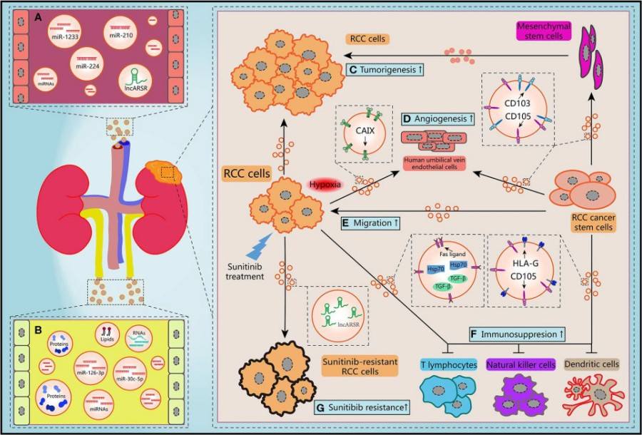 Fig.1 Lung adenocarcinoma tissue exosomes. (Yang, et al., 2022) (OA Literature)
