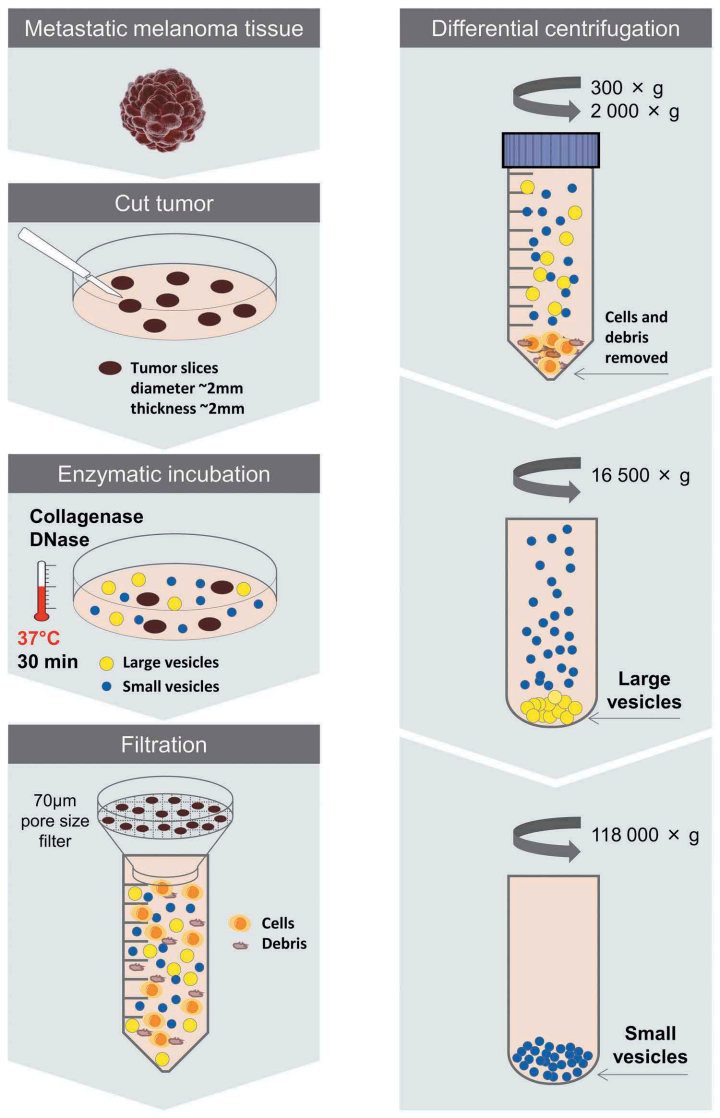 Fig.1 Exosomes from metastatic melanoma tissue. (Crescitelli, et al., 2020) (OA Literature)