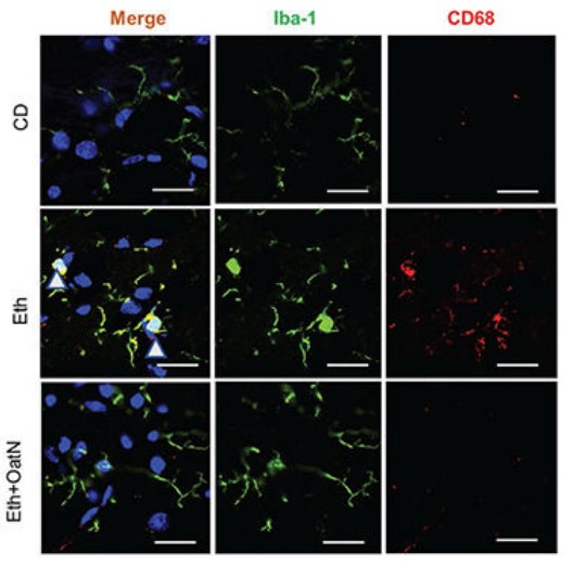 Fig.1 Oat-derived exosomes inhibits alcohol induced brain inflammation. (Xu, et al., 2022)