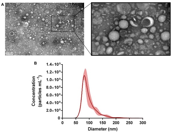 Fig. 1 Propionibacterium freudenreichii-derived exosome characterization. (Rodovalho, et al., 2020)