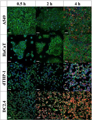 Fig.1 Cells uptake exosomes from Streptococcus pneumoniae.