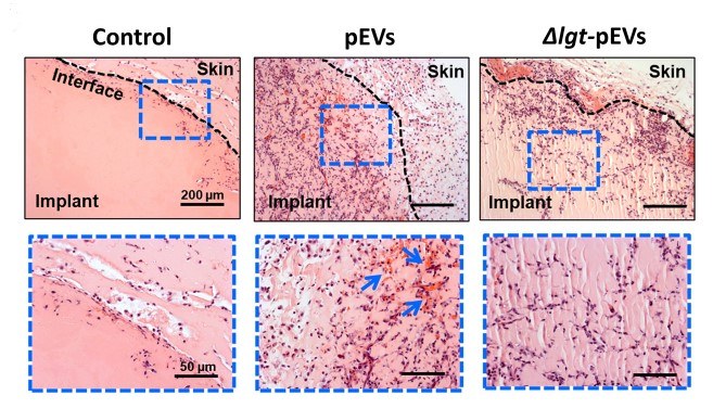 Fig.2 Exosomes from Streptococcus pneumoniae stimulate the recruitment of host cells.