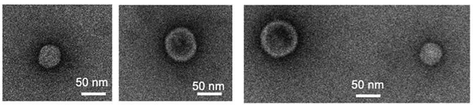 Fig.1 Exosomes Derived from Escherichia coli: A TEM Analysis.