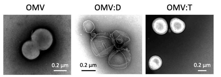 Fig.1 Neisseria lactamica-derived exosome TEM images.