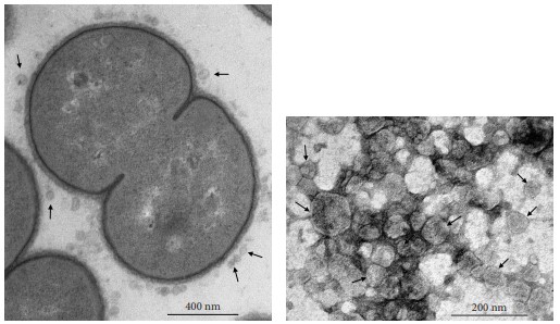 Fig.1 Images of Moraxella catarrhalis releasing vesicles and exosomes.