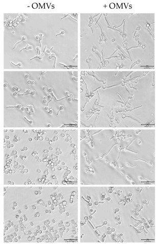 Fig.2 Exosomes from Moraxella catarrhalis enhance yeast filament retention.