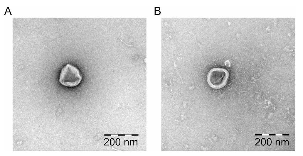Fig.1 TEM analysis of exosomes derived from Malassezia.