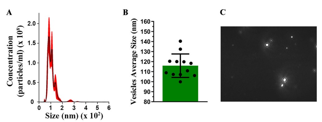 Fig.1 Aspergillus flavus-derived exosome analysis by NTA.