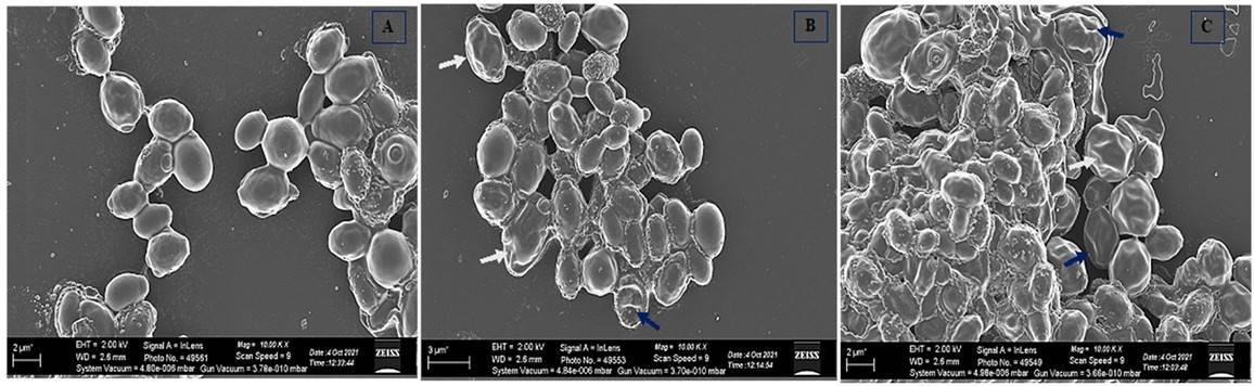 Fig.1 Candida auris SEM.