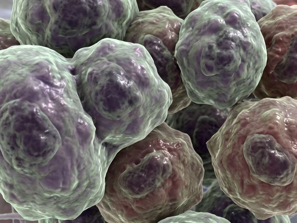 Fig.1 Cancerous liver cells. (Creative Biolabs AI)