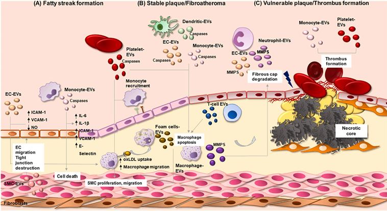 The role of extracellular vesicles in vascular inflammation and atherosclerosis. (Charla, et al., 2020)