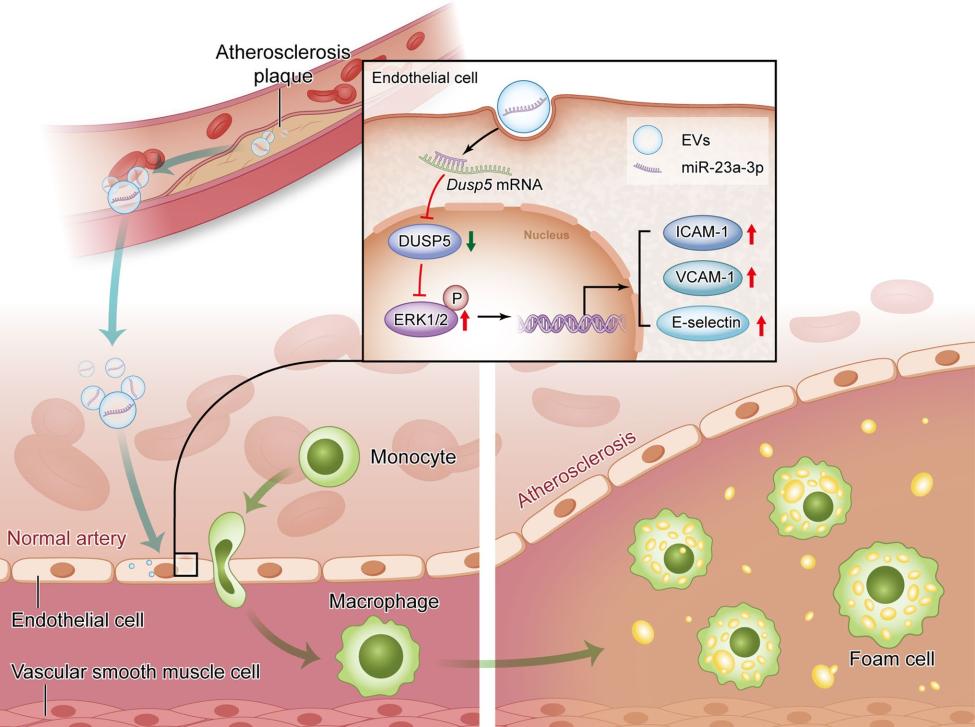 Schematic diagram of the mechanisms of EV-mediated atherosclerosis spread.