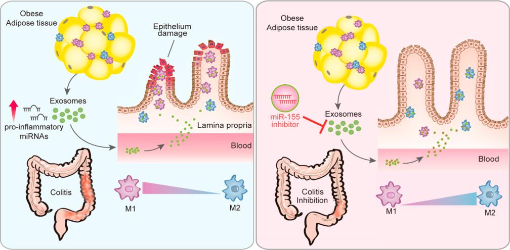 Schematic illustration of the study in which visceral adipose tissue derived exosomes exacerbate colitis severity.