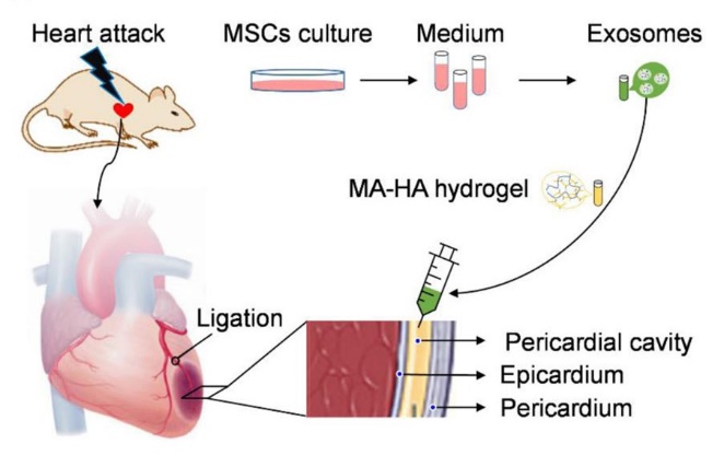 Fig.2 Schematic showing intrapericardial delivery of exosomes for minimally invasive (MI) therapy.