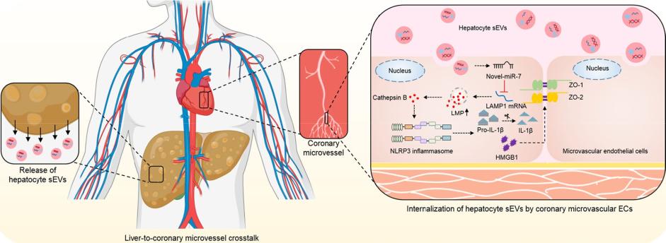 Graphical abstract of NAFLD-derived exosomes (sEVs) increasing microvascular endothelial permeability.