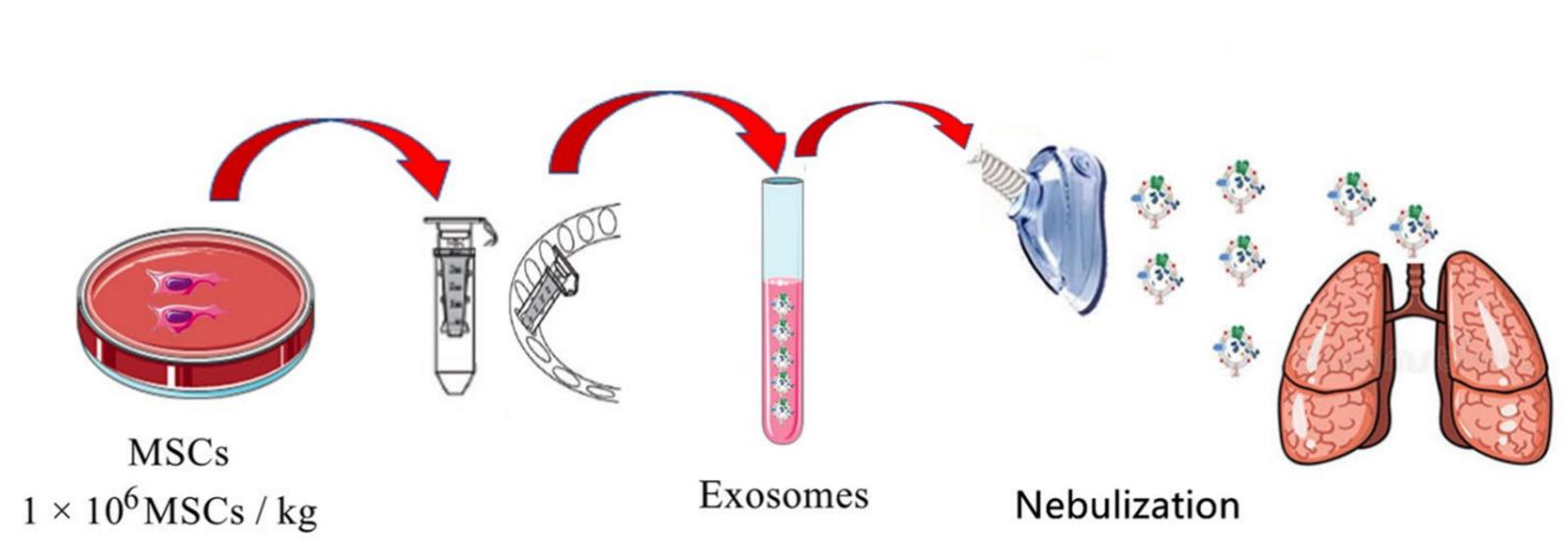 Fig.1 Schematic diagram of nebulization treatment of MSC (mesenchymal stem cell)-derived exosomes.