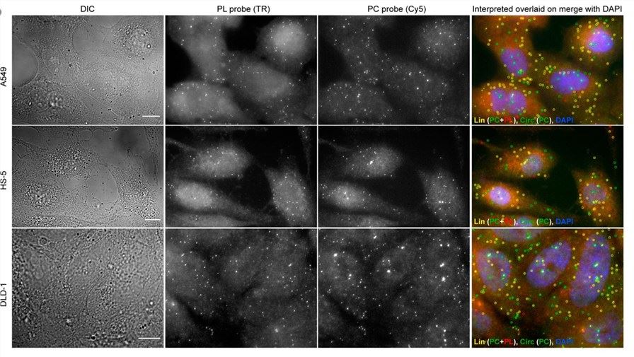 Representative circFISH images of target RNA in tumor cells using PL and PC probes. (OA Literature)