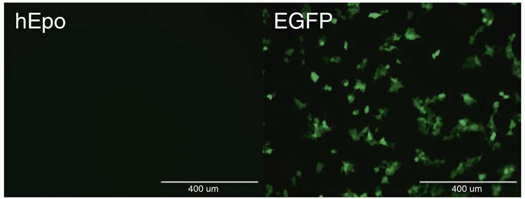The expression of circRNA-EGFP in HEK293 cells 24 h after transfection. (Wesselhoeft, et al., 2018)
