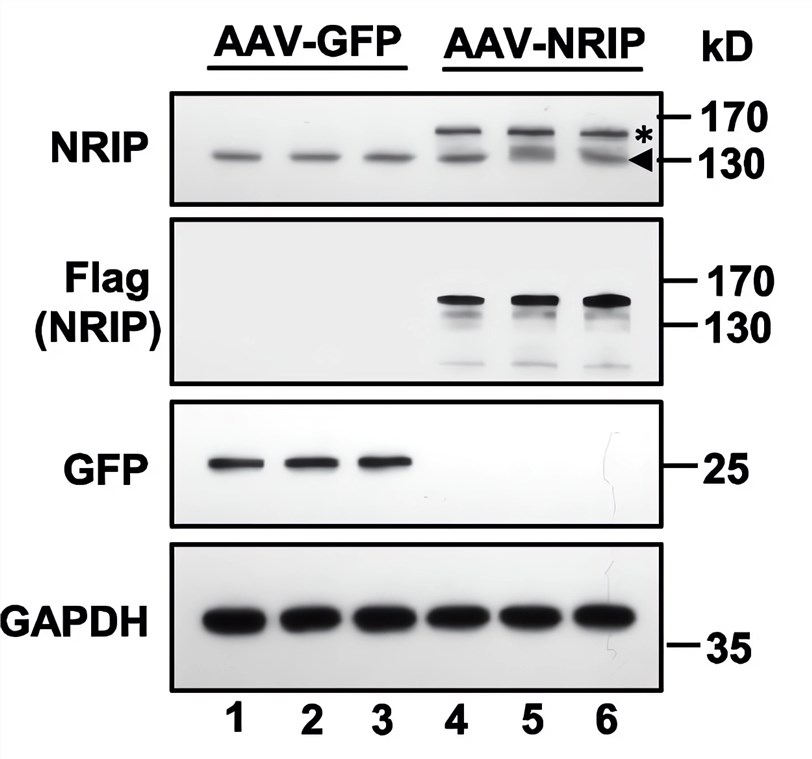 The expression levels of related genes of AAV-GFP and AAV-NRIP were detected by a western blot experiment. (OA Literature)