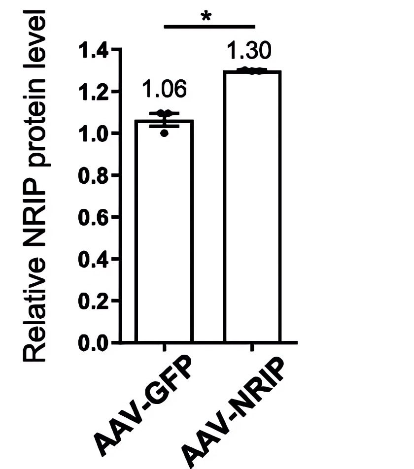 The results of the western blot experiment were statistically analyzed. (OA Literature)