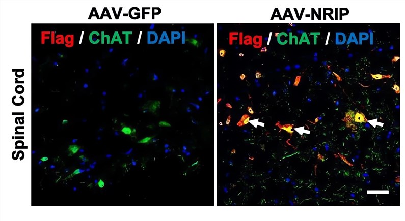 The expression level and localization of NRIP in cells treated with AAV-NRIP were observed by immunofluorescence assay. (OA Literature)