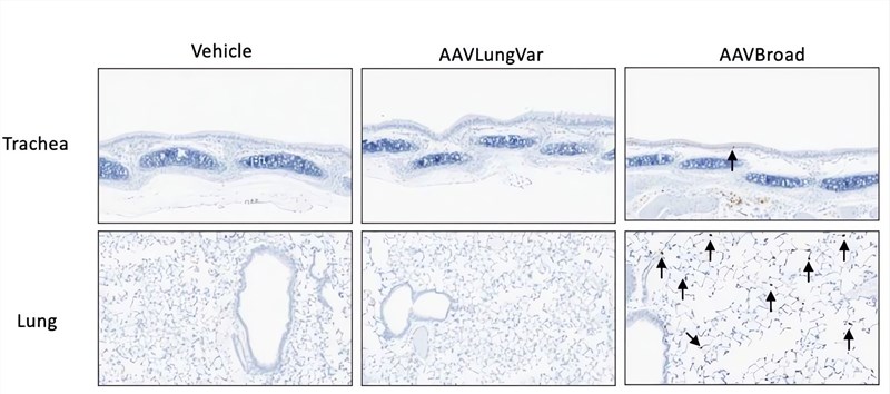 AAV exhibits different pulmonary tropism in mice depending on the different transport routes. (OA Literature)