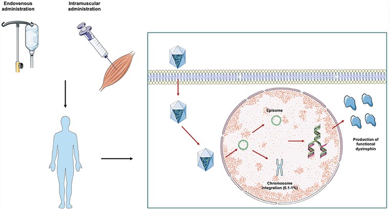AAV can be used for the treatment of cystic fibrosis, and it can be corrected in vitro in collected cells through editing strategies. (OA Literature)