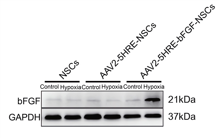 The expression of bFGF protein in the target cells was detected by a Western blot experiment. (OA Literature)