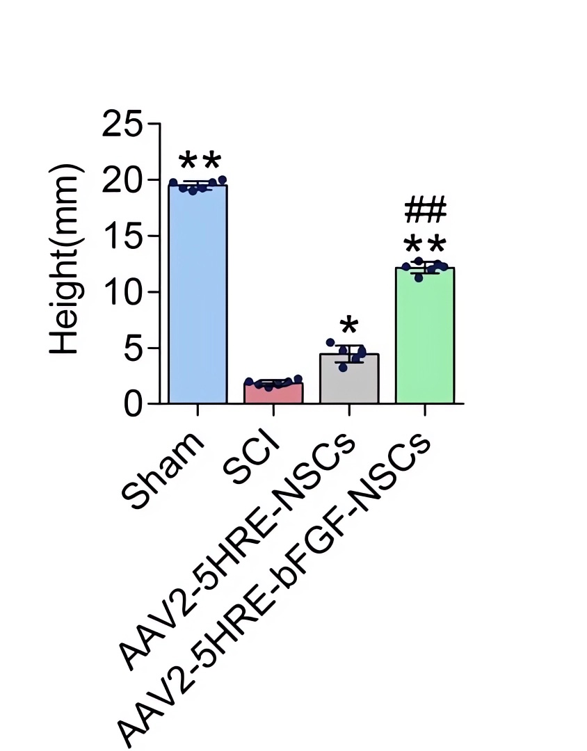 The hind leg load-bearing capacity of rats in the control group and the AAV-HRE-bFGF-NSC treatment group. (OA Literature)