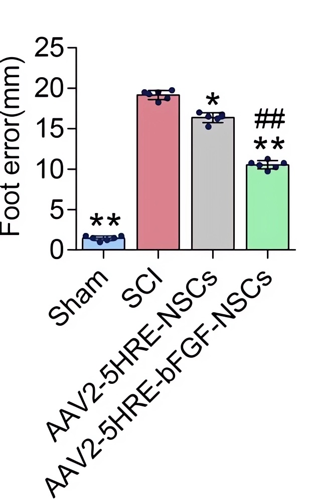 The foot error frequency of rats in the control group and the AAV-HRE-bFGF-NSC treatment group. (OA Literature)