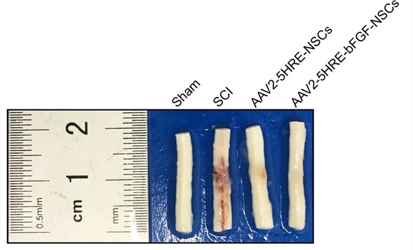 The spinal cord changes were observed by dissecting the rats in the control group and the AAV-HRE-bFGF-NSC treatment group. (OA Literature)